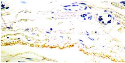 Immunohistochemistry-Paraffin: Elastin Antibody (BA-4) [NB100-2076]