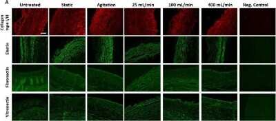 Immunohistochemistry-Paraffin: Elastin Antibody (BA-4) [NB100-2076]