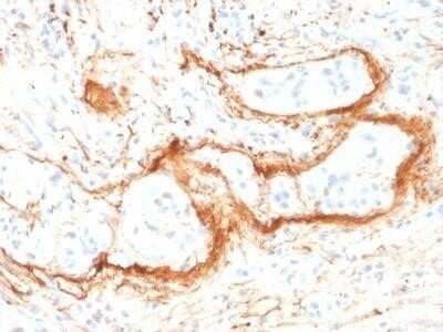 Immunohistochemistry-Paraffin: Elastin Antibody (ELN/1981) - Azide and BSA Free [NBP2-75770]