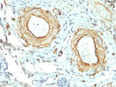 Immunohistochemistry-Paraffin: Elastin Antibody (ELN/2069) - Azide and BSA Free [NBP3-08889]