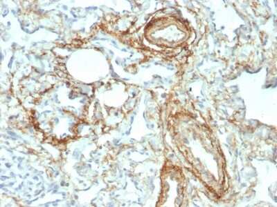 Immunohistochemistry-Paraffin: Elastin Antibody (ELN/2069) - Azide and BSA Free [NBP3-08889]