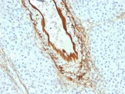 Immunohistochemistry-Paraffin: Elastin Antibody (ELN/2069) [NBP3-07147]