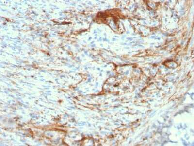 Immunohistochemistry-Paraffin: Elastin Antibody (ELN/3131R) - Azide and BSA Free [NBP3-08890]