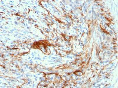 Immunohistochemistry-Paraffin: Elastin Antibody (ELN/3131R) - Azide and BSA Free [NBP3-08890]