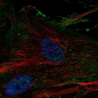 Immunocytochemistry/ Immunofluorescence: Elastin Antibody [NBP2-33805]