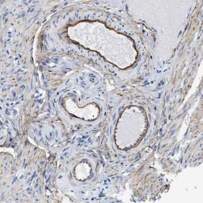 Immunohistochemistry-Paraffin: Elastin Antibody [NBP1-80710]