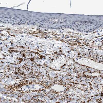 Immunohistochemistry-Paraffin: Elastin Antibody [NBP1-80710]
