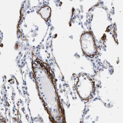 Immunohistochemistry-Paraffin: Elastin Antibody [NBP1-80710]