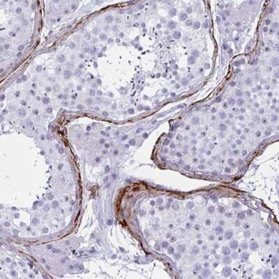 Immunohistochemistry-Paraffin: Elastin Antibody [NBP2-33805]