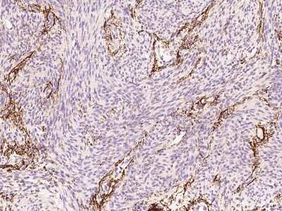 Immunohistochemistry-Paraffin: Elastin Antibody [NBP2-97589]