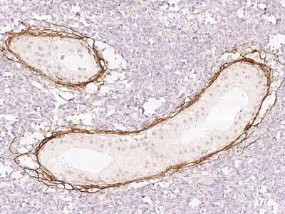 Immunohistochemistry-Paraffin: Elastin Antibody [NBP2-97589]