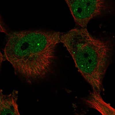 Immunocytochemistry/ Immunofluorescence: Elf4/MEF Antibody [NBP2-56927]