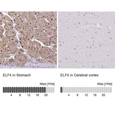 Immunohistochemistry-Paraffin: Elf4/MEF Antibody [NBP2-33286]