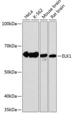 Western Blot: Elk-1 Antibody (10U8X1) [NBP3-15631]