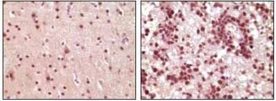 Immunohistochemistry-Paraffin: Elk-1 Antibody (3H6D12) - BSA Free [NBP1-47553]