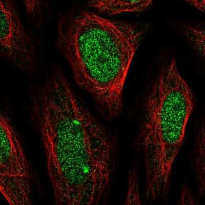 Immunocytochemistry/ Immunofluorescence: Elk-1 Antibody [NBP2-57053]