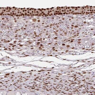 Immunohistochemistry-Paraffin: Elk-1 Antibody [NBP2-38278]