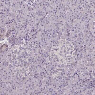 Immunohistochemistry-Paraffin: Elk-1 Antibody [NBP2-38278]