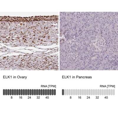 Immunohistochemistry-Paraffin: Elk-1 Antibody [NBP2-38278]