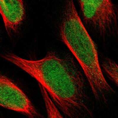 Immunocytochemistry/ Immunofluorescence: Ellis van Creveld syndrome Antibody [NBP1-84038]