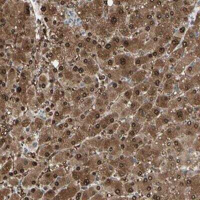 Immunohistochemistry-Paraffin: Ellis van Creveld syndrome Antibody [NBP1-84039]