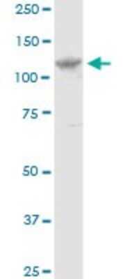 Western Blot: Ellis van Creveld syndrome Antibody [H00002121-B01P]