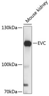 Western Blot: Ellis van Creveld syndrome AntibodyAzide and BSA Free [NBP3-03796]