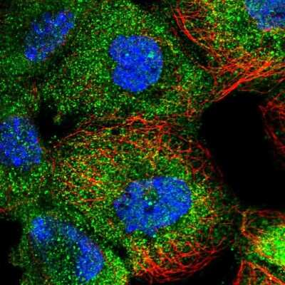 Immunocytochemistry/ Immunofluorescence: Ells1 Antibody [NBP1-90477]