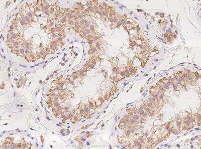 Immunohistochemistry-Paraffin: Ells1 Antibody [NBP3-05896]