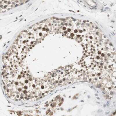 Immunohistochemistry-Paraffin: Elongin A Antibody [NBP1-87040]