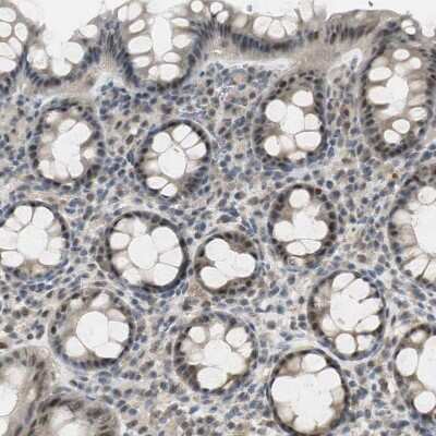 Immunohistochemistry-Paraffin: Elongin A Antibody [NBP1-87040]