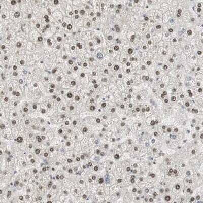 Immunohistochemistry-Paraffin: Elongin A Antibody [NBP1-87040]