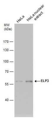 Western Blot: Elp3 Antibody (11811) [NBP2-43694]