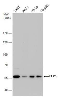 Western Blot: Elp3 Antibody (11811) [NBP2-43694]