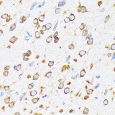 Immunohistochemistry-Paraffin: Elp3 Antibody (3R3U5) [NBP3-15245]