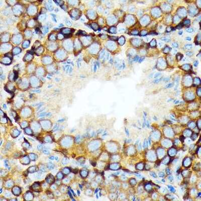 Immunohistochemistry-Paraffin: Elp3 Antibody (3R3U5) [NBP3-15245]