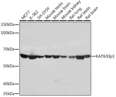 Western Blot: Elp3 Antibody (3R3U5) [NBP3-15245]