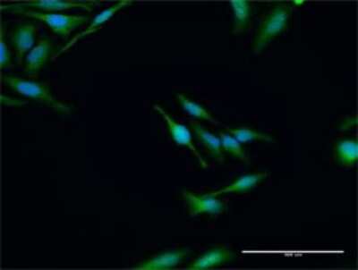 Immunocytochemistry/ Immunofluorescence: Elp3 Antibody [H00055140-D01P]