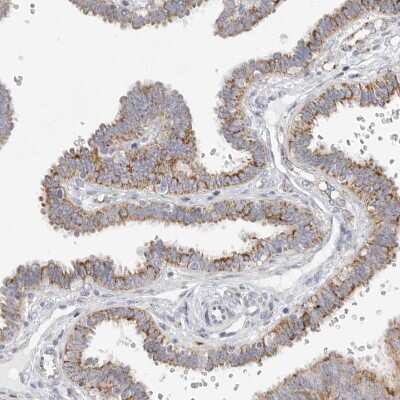 Immunohistochemistry-Paraffin: Elp3 Antibody [NBP1-84625]