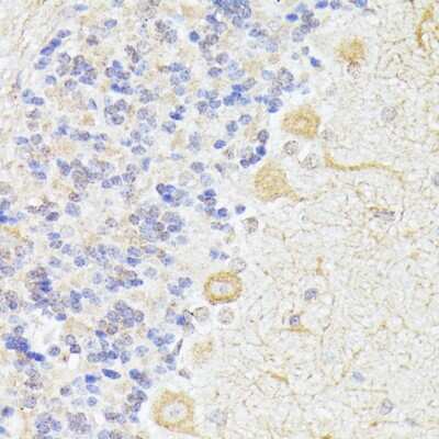 Immunohistochemistry-Paraffin: Elp3 Antibody - Azide and BSA Free [NBP3-04985]