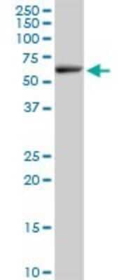 Western Blot: Elp3 Antibody [H00055140-B01P]