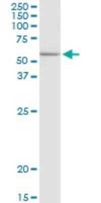 Western Blot: Elp3 Antibody [H00055140-D01P]