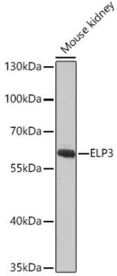 Western Blot: Elp3 AntibodyAzide and BSA Free [NBP3-04985]