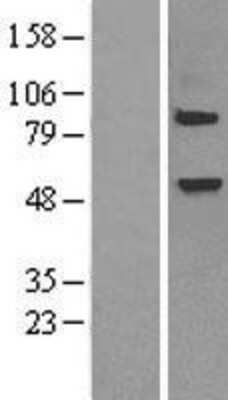 Western Blot: Elp3 Overexpression Lysate [NBP2-04367]