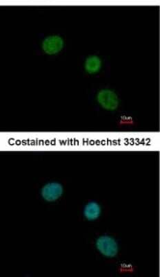 Immunocytochemistry/ Immunofluorescence: Elp4 Antibody [NBP2-16322]