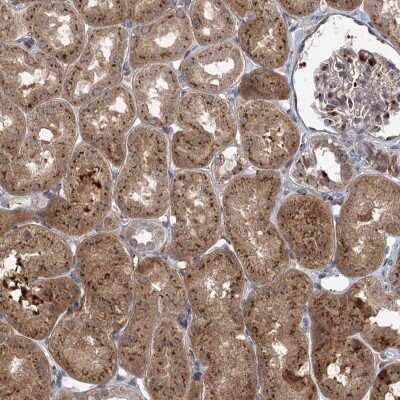 Immunohistochemistry: Elp4 Antibody [NBP2-47472]