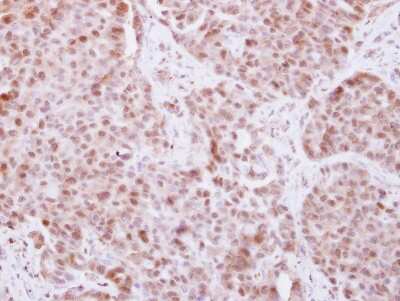 Immunohistochemistry-Paraffin: Elp4 Antibody [NBP2-16322]