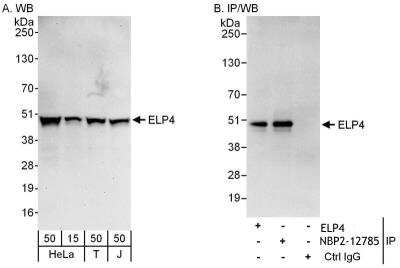 Immunoprecipitation: Elp4 Antibody [NBP2-12785]