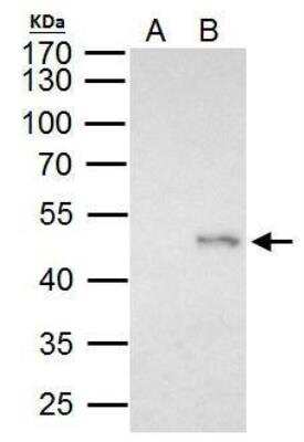 Immunoprecipitation: Elp4 Antibody [NBP2-16322]