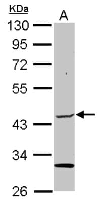 Western Blot: Elp4 Antibody [NBP2-16322]